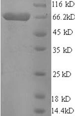 Recombinant Pig Electron transfer flavoprotein-ubiquinone oxidoreductase, mitochondrial (ETFDH)
