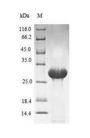Recombinant Human Coagulation factor VII (F7), partial