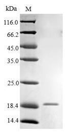 Recombinant Human High affinity immunoglobulin epsilon receptor subunit gamma (FCER1G), partial