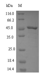Recombinant Human Squalene synthase (FDFT1), partial