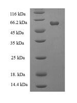 Recombinant Human Galactose-1-phosphate uridylyltransferase (GALT)