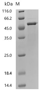 Recombinant Human Galactose-1-phosphate uridylyltransferase (GALT)