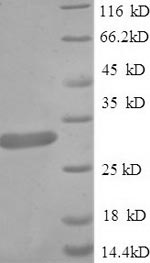 Recombinant Rat Guanidinoacetate N-methyltransferase (Gamt)