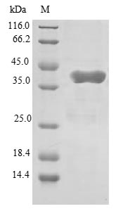 Recombinant Human Glutamyl-tRNA (Gln) amidotransferase subunit C, mitochondrial (GATC)