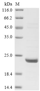 Recombinant Human Interferon-induced guanylate-binding protein 2 (GBP2), partial