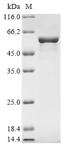 Recombinant Human Glial fibrillary acidic protein (GFAP)