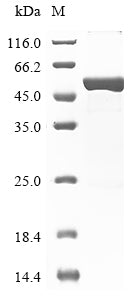 Recombinant Human Glial fibrillary acidic protein (GFAP)