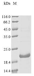 Recombinant Mouse Gastric inhibitory polypeptide receptor(Gipr), partial