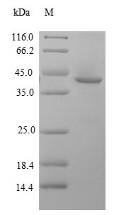 Recombinant Human Zinc finger protein GLI2 (GLI2), partial