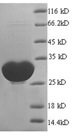 Recombinant Human Glioma pathogenesis-related protein 1 (GLIPR1), partial
