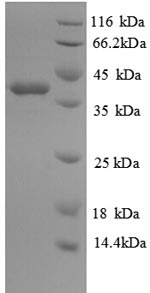 Recombinant Human Glutaredoxin-1 (GLRX)