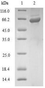 Recombinant Human Glutaredoxin-3 (GLRX3)