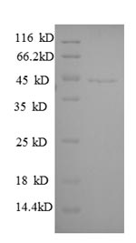 Recombinant Human Guanine nucleotide-binding protein G (i) subunit alpha-3 (GNAI3)