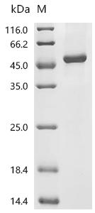 Recombinant Human Glycogen synthase kinase-3 beta (GSK3B)(K85P)