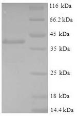 Recombinant Mouse Glutathione S-transferase P 1 (Gstp1)