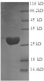 Recombinant Rat Glutathione S-transferase P (Gstp1)