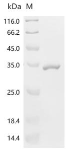 Recombinant Human Glutathione S-transferase theta-1 (GSTT1)