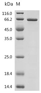 Recombinant Human Protein HEXIM1 (HEXIM1)