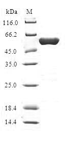 Recombinant Human Hydroxymethylglutaryl-CoA lyase, mitochondrial (HMGCL)