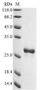 Recombinant Human Hypoxanthine-guanine phosphoribosyltransferase (HPRT1)