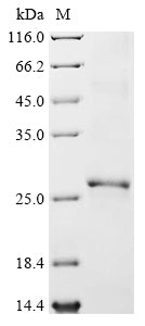 Recombinant Human Hypoxanthine-guanine phosphoribosyltransferase (HPRT1)
