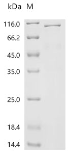 Recombinant Mouse Heat shock protein HSP 90-beta (Hsp90ab1)