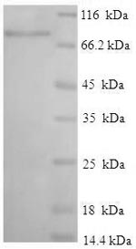 Recombinant Human Interferon-induced protein with tetratricopeptide repeats 3 (IFIT3)