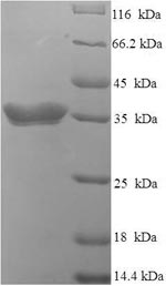 Recombinant Human Interferon alpha-4 (IFNA4), partial