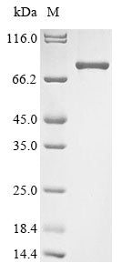 Recombinant Mouse Zinc finger protein Helios (Ikzf2)