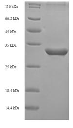 Recombinant Bovine Inhibin alpha chain (INHA)