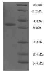 Recombinant Human Integrin alpha-IIb (ITGA2B), partial