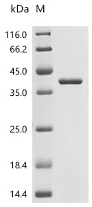 Recombinant Human Integrin alpha-IIb (ITGA2B), partial