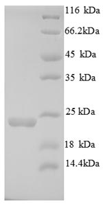 Recombinant Mouse Integrin alpha-L (Itgal), partial