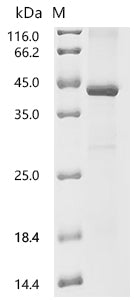 Recombinant Mouse Galectin-9 (Lgals9)