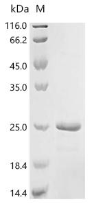 Recombinant Mouse Galectin-9 (Lgals9), partial