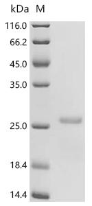 Recombinant Horse Lutropin/choriogonadotropin subunit beta (LHB)