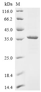 Recombinant Rat Lutropin-choriogonadotropic hormone receptor (Lhcgr), partial