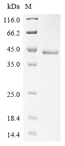 Recombinant Human Lysosomal acid lipase/cholesteryl ester hydrolase (LIPA)