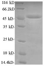 Recombinant Human Lysosomal acid lipase/cholesteryl ester hydrolase (LIPA)