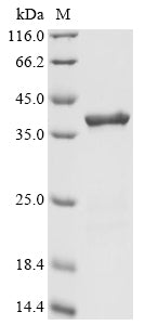 Recombinant Human Lon protease homolog, mitochondrial (LONP1), partial