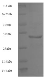 Recombinant Human U6 snRNA-associated Sm-like protein LSm4 (LSM4)