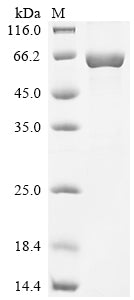 Recombinant Human Tyrosine-protein kinase Lyn (LYN)
