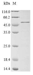 Recombinant Human Melanoma-associated antigen 3 (MAGEA3)