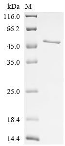 Recombinant Human Melanoma-associated antigen 3 (MAGEA3)