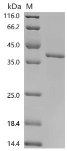 Recombinant Human Matrix metalloproteinase-14 (MMP14), partial