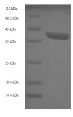 Recombinant Human 39S ribosomal protein L42, mitochondrial (MRPL42)