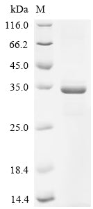 Recombinant Human 28S ribosomal protein S21, mitochondrial (MRPS21)