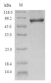 Recombinant Human Nicotinate phosphoribosyltransferase (NAPRT), partial