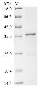 Recombinant Human Arylamine N-acetyltransferase 1 (NAT1)