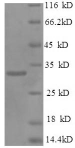 Recombinant Human NK-tumor recognition protein (NKTR), partial